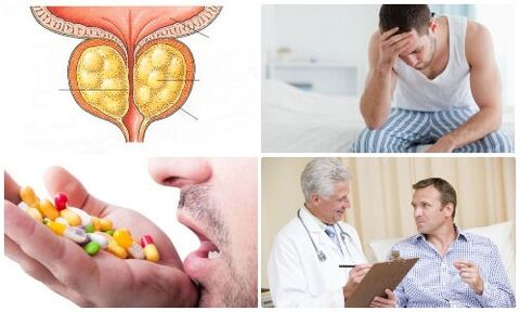 erkaklarda prostatit