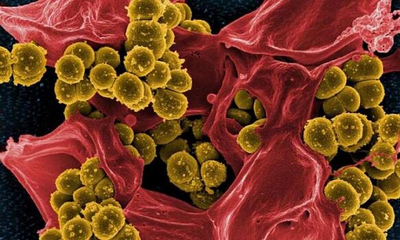 Staphylococcus aureus bakterial prostatitning sababi sifatida